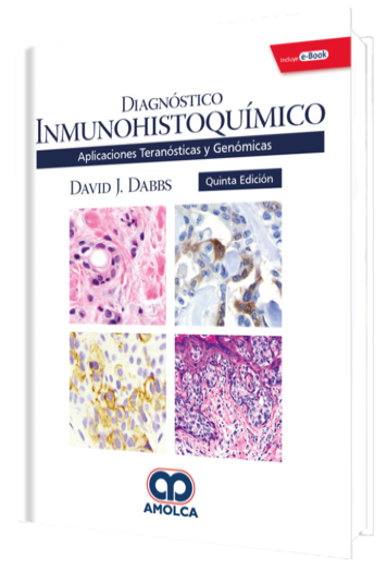 Diagnóstico Inmunohistoquímico Aplicaciones Teranósticas y Genómicas 5 Edición