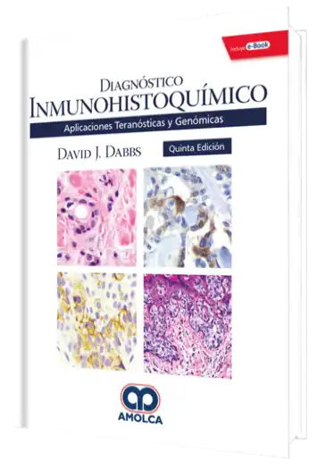 Diagnóstico Inmunohistoquímico Aplicaciones Teranósticas y Genómicas 5 Edición