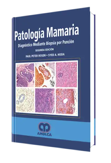 Patología Mamaria. Diagnóstico Mediante Biopsia por Punción 2 Edición