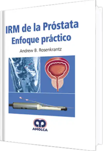 IRM de la Próstata Enfoque Práctico