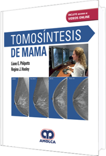 Tomosíntesis de Mama