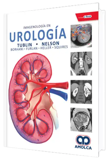 Imagenología en Urología