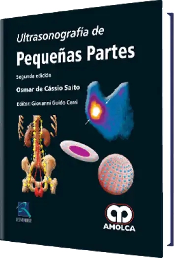 Ultrasonografía de Pequeñas Partes. 2 Edición