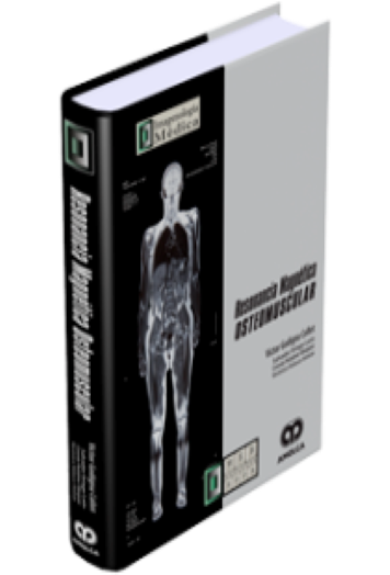 Resonancia Magnética Osteomuscular