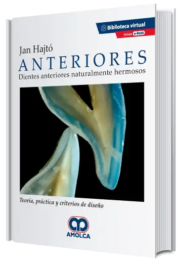 Anteriores. Dientes Anteriores Naturalmente Hermosos. Teoría, Práctica y Criterios de Diseño