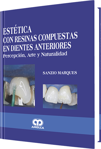 Estética con Resinas Compuestas en Dientes Anteriores