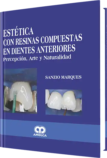 Estética con Resinas Compuestas en Dientes Anteriores