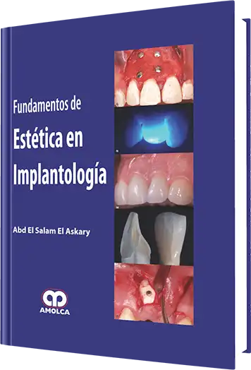 Fundamentos de Estética en Implantología