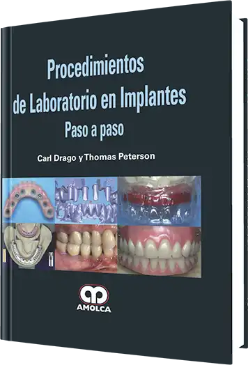 Procedimientos de Laboratorio en Implantes Paso a Paso.