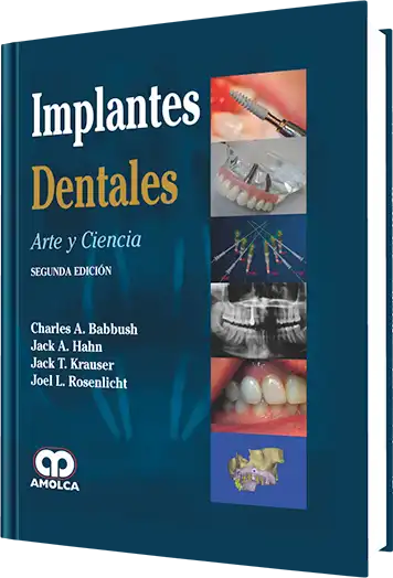 Implantes Dentales. Arte y Ciencia. 2 Edición