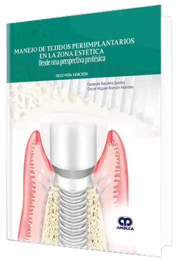 Manejo de Tejidos Periimplantarios en la Zona Estética. Desde una Perspectiva Protésica. 2 edición