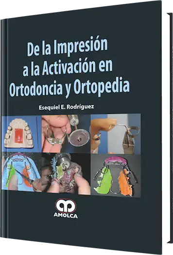 De la Impresión a la Activación en Ortodoncia y Ortopedia