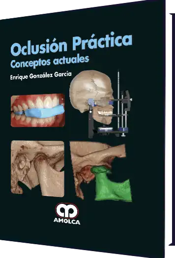 Oclusión Práctica - Conceptos Actuales. 2 Edición