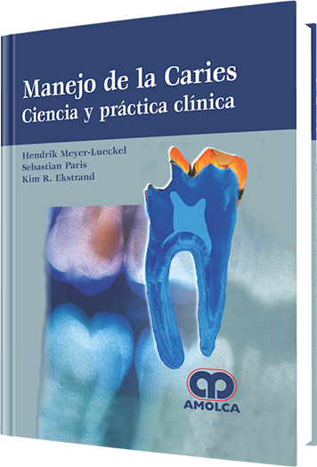 Manejo de la Caries Ciencia y práctica clínica