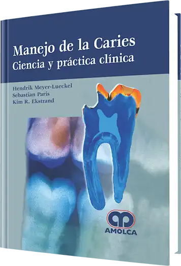 Manejo de la Caries Ciencia y práctica clínica