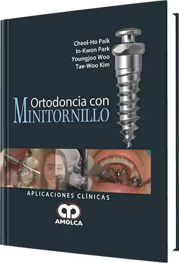 Ortodoncia con Minitornillo