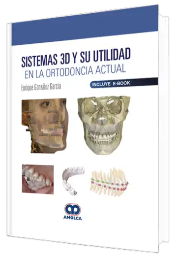 Sistemas 3D y su Utilidad en la Ortodoncia Actual