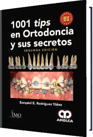 1001 tips en Ortodoncia y sus Secretos 2 Edición