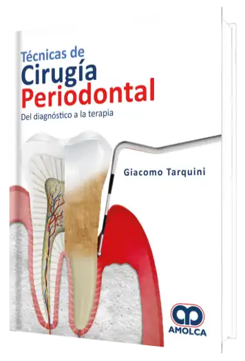 Técnicas de Cirugía Periodontal del Diagnóstico a la Terapia