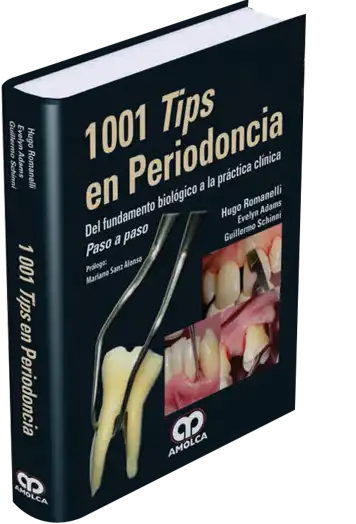 1001 Tips en Periodoncia