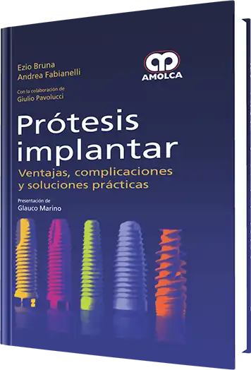 Prótesis Implantar