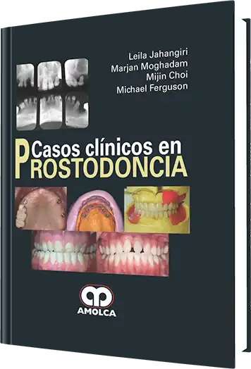 Casos Clínicos en Prostodoncia