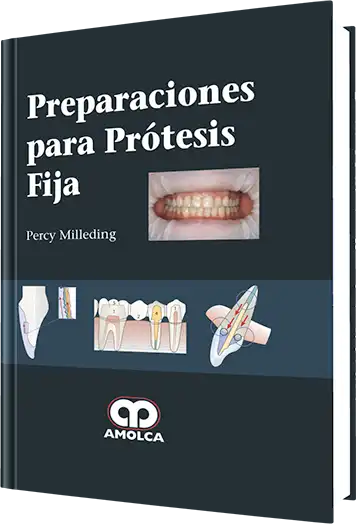 Preparaciones para Prótesis Fija