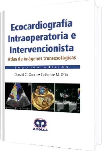 Ecocardiografía Intraoperatoria e Intervencionista 2 Edición