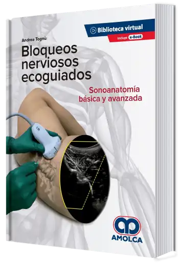 Bloqueos Nerviosos Ecoguiados. Sonoanatomía Básica y Avanzada