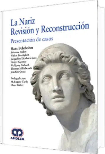 La Nariz Revisión y Reconstrucción. Presentación de Casos