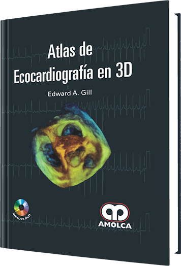 Atlas de Ecocardiografía en 3D