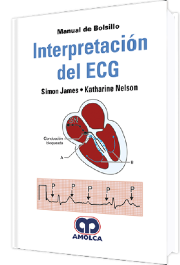 Manual de Bolsillo Interpretación del ECG