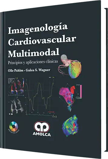 Imagenología Cardiovascular Multimodal