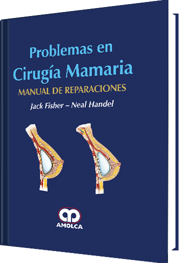 Problemas en Cirugía Mamaria