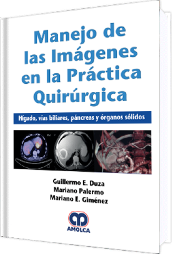 Manejo de las Imágenes en la Práctica Quirúrgica / Hígado, Vías Biliares, Páncreas y Órganos Sólidos