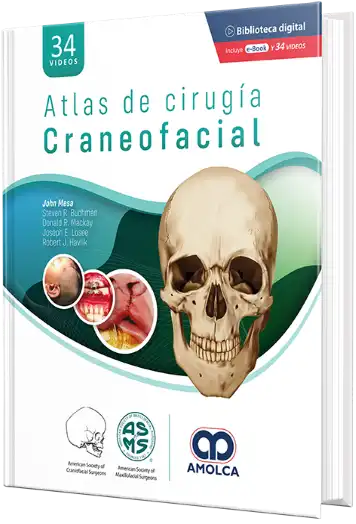 Atlas de Cirugía Craneofacial