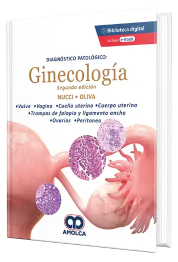 Diagnóstico Patológico: Ginecología. 2 Edición