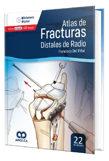 Atlas de Fracturas Distales de Radio