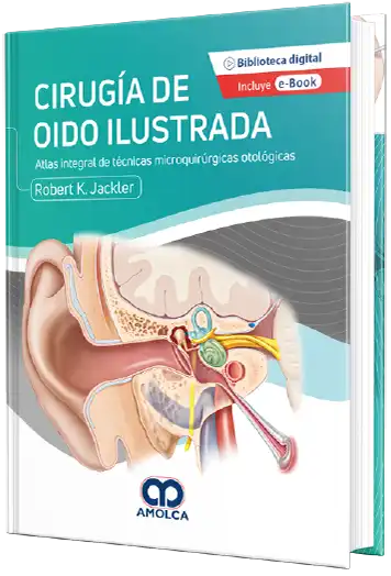 Cirugía de Oido Ilustrada