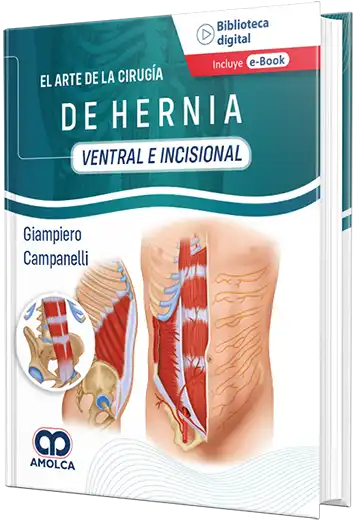 El arte de la Cirugía de la Hernia - Ventral e Incisional