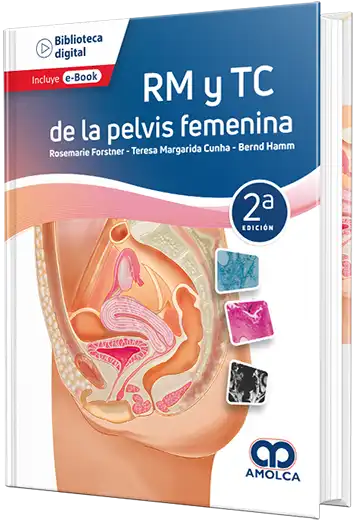 RM y TC de la pelvis femenina