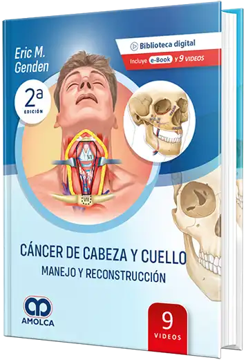 Cáncer de Cabeza y Cuello - Manejo y Reconstrucción