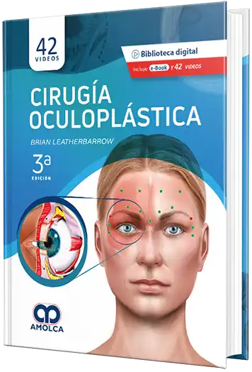 Cirugía Oculoplástica 3a Edición