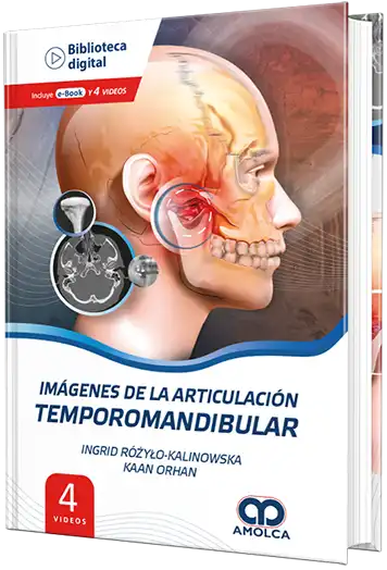 Imágenes de la Articulación Temporomandibular