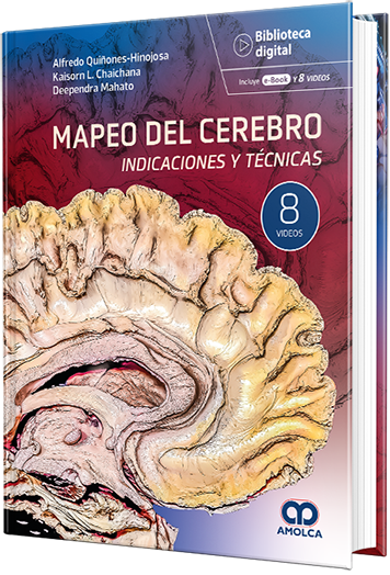 Mapeo del cerebro