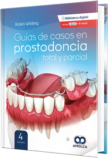 Guías de casos en prostodoncia total y parcial