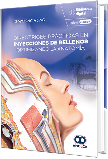 Directrices prácticas en inyecciones de rellenos optimizando la anatomía